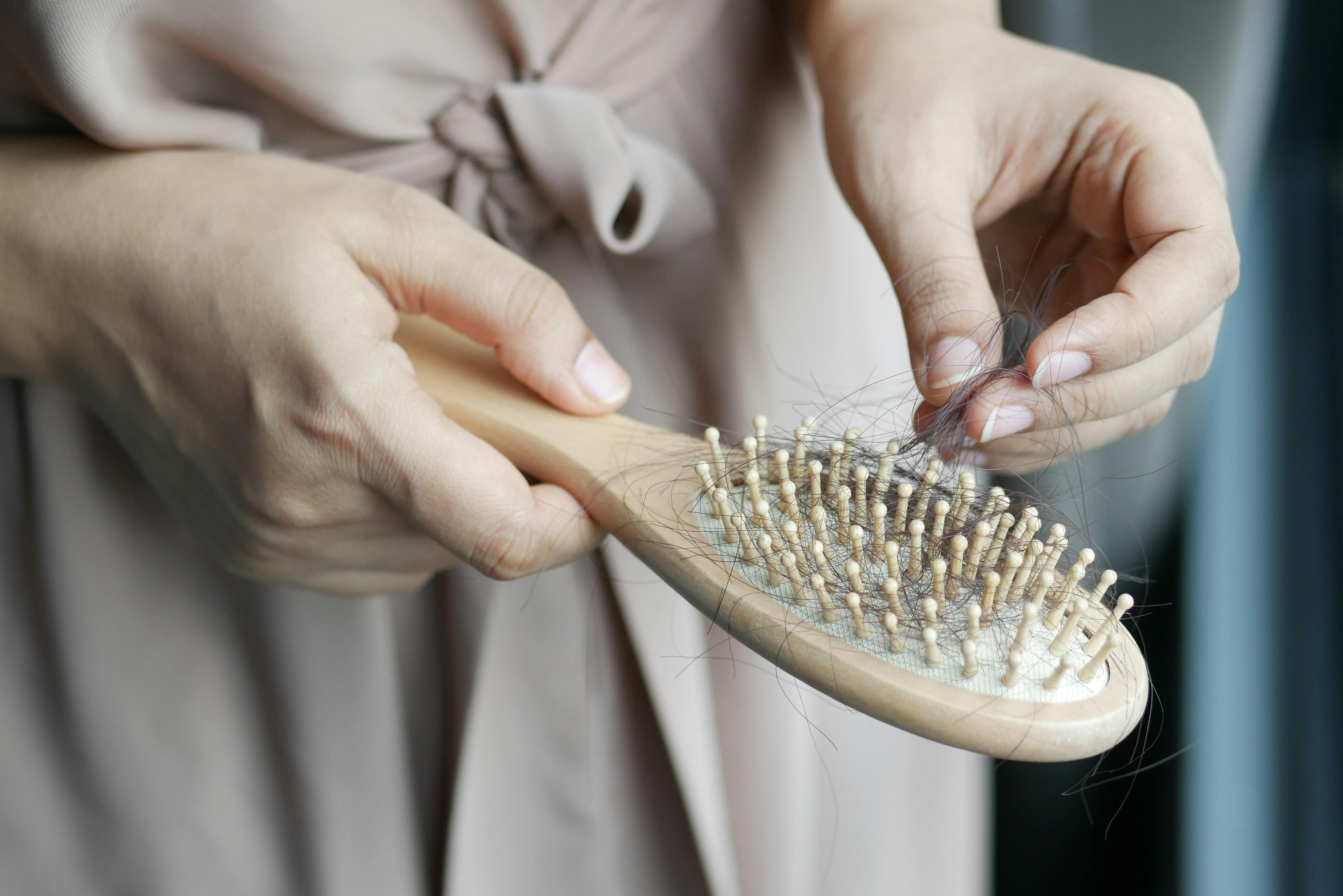 I’m Losing My Hair During Cancer Treatment — Now What?